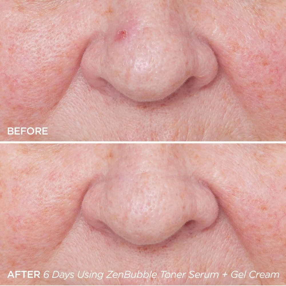 Beautybio ZenBubble Bi-Phase serum 50 ml - Picture 4 of 6